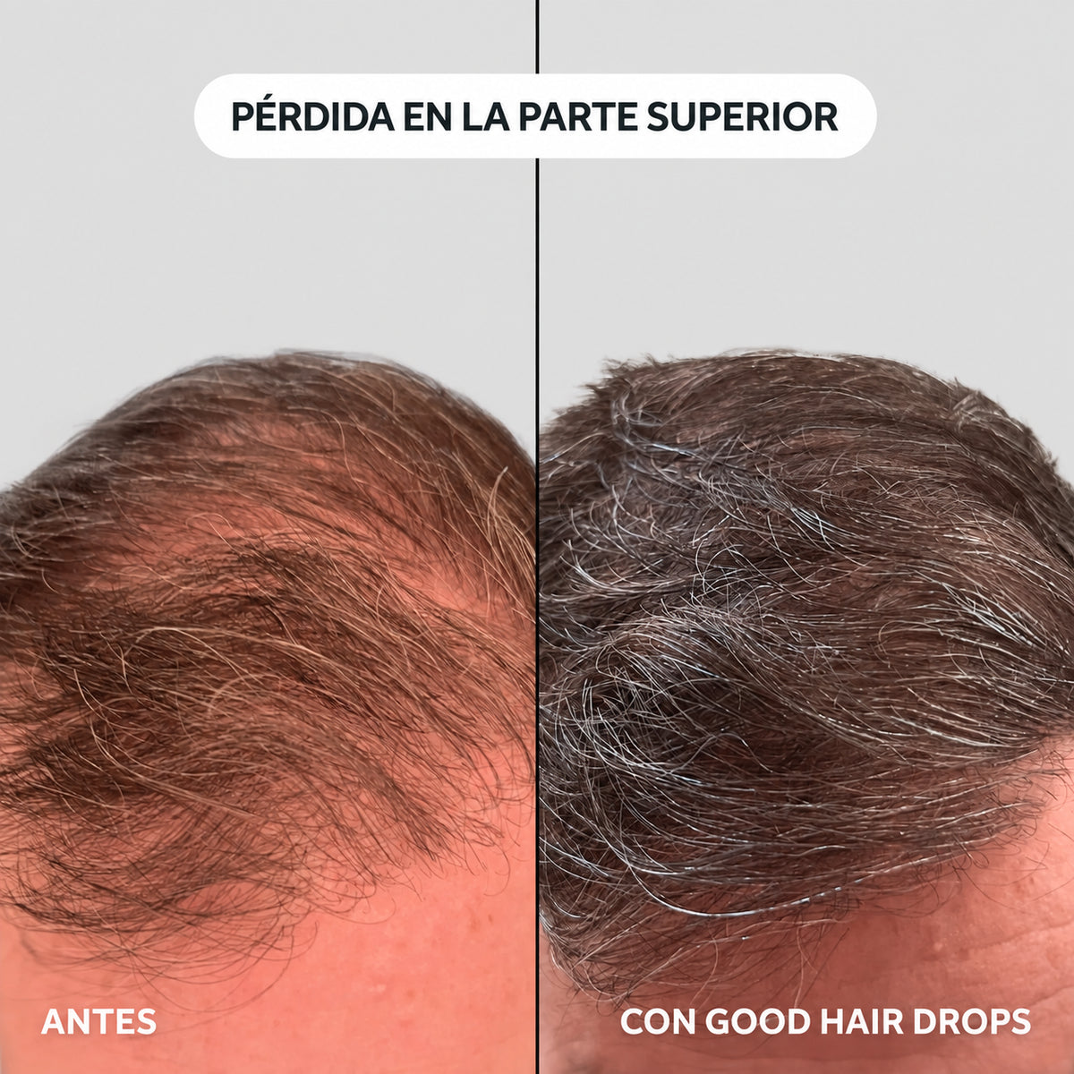 Serúm roll on para el crecimiento del pelo