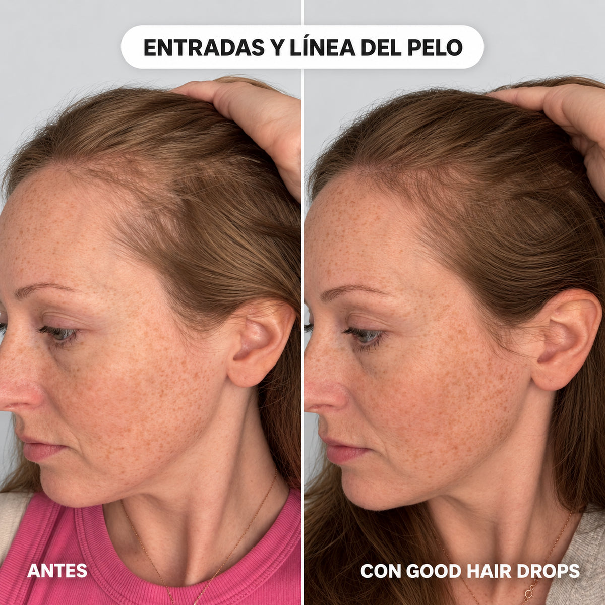 Serúm roll on para el crecimiento del pelo