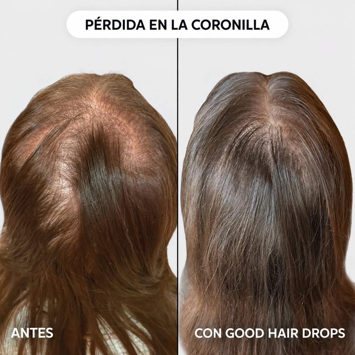Serúm roll on para el crecimiento del pelo